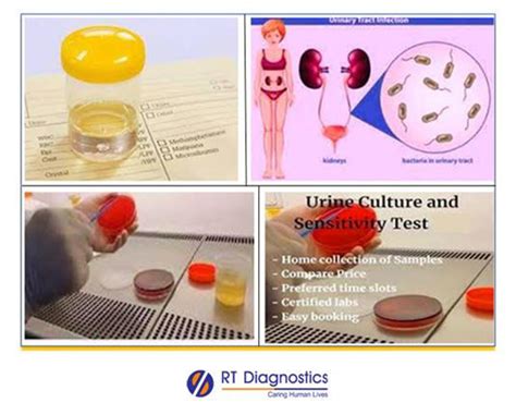 what is urine re and cs test|Urine Culture .